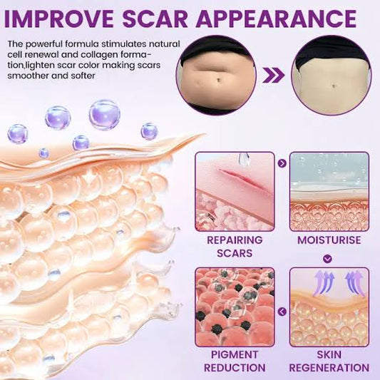 COMBO TIMILK Scar Vanisher Gel – Advanced Silicone Formula for Scars, Stretch Marks & Smooth Skin (Before & After Results)