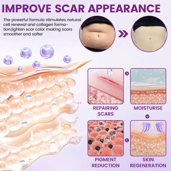 COMBO TIMILK Scar Vanisher Gel – Advanced Silicone Formula for Scars, Stretch Marks & Smooth Skin (Before & After Results)