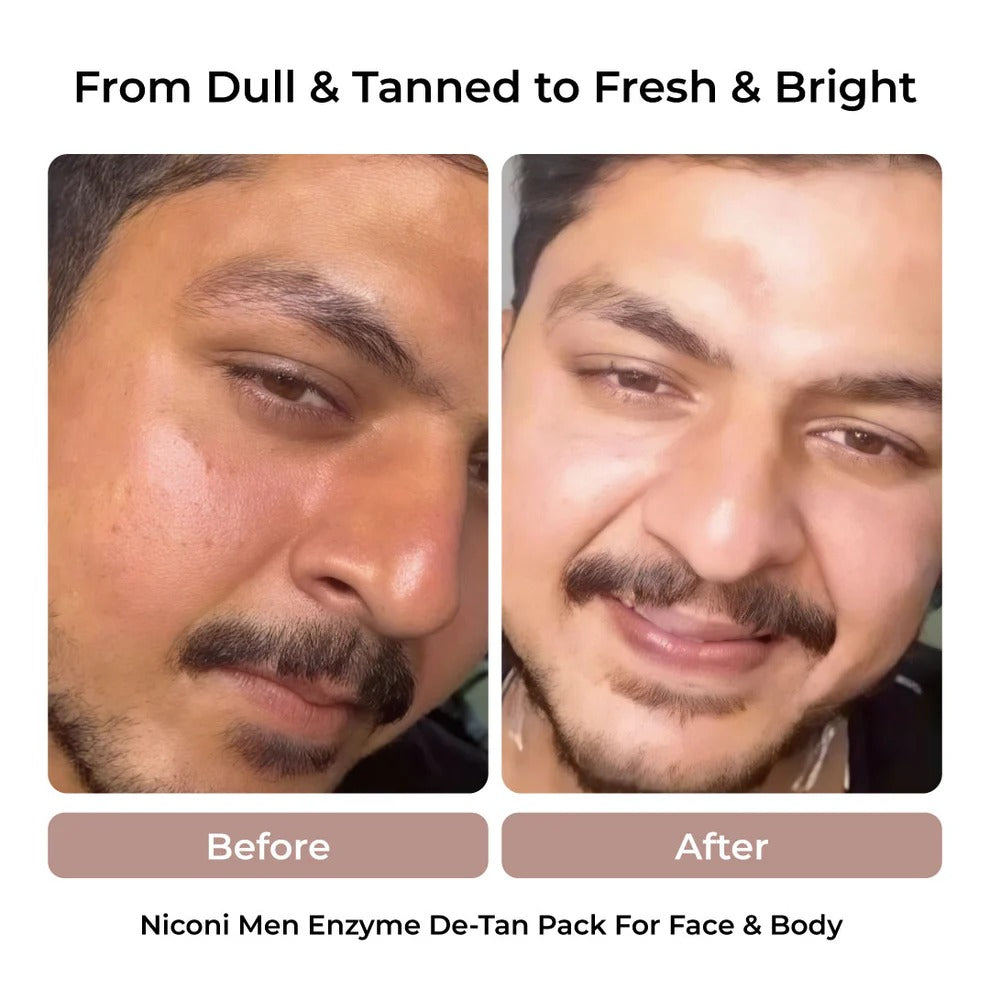 The Ultimate De-Tan Combo for Men