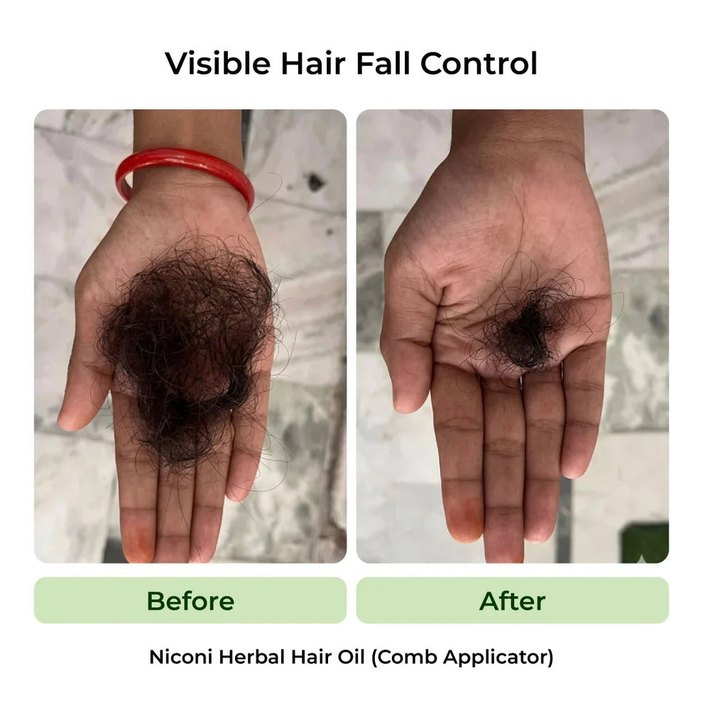 The Anti-Dandruff Hair Revival Combo